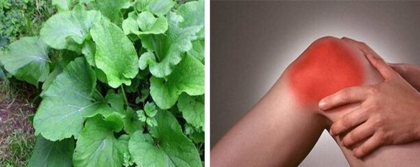 Vorteile von Kletten bei Arthrose des Kniegelenks