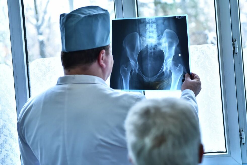 Der Arzt betrachtet ein Bild eines Hüftgelenks mit Arthrose.