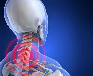 Die Lage der Schmerz in den zervikalen Osteochondrose